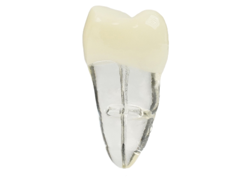 Endodonti